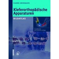 Kieferorthopädische Apparaturen Kieferorthopädische Apparaturen