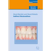 Indirect Restorations