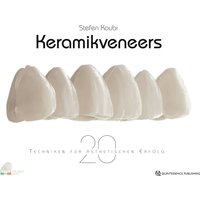 Keramikveneers