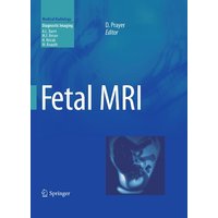 Fetal MRI