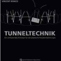 Tunneltechnik