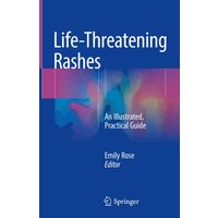Life-Threatening Rashes