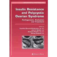 Insulin Resistance and Polycystic Ovarian Syndrome