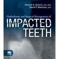 Orthodontic and Surgical Management of Impacted Teeth