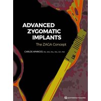 Advanced Zygomatic Implants