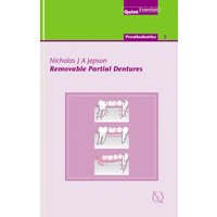 Removable Partial Dentures