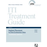Implant Placement in Post-Extraction Sites