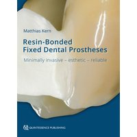 Resin-Bonded Fixed Dental Prostheses