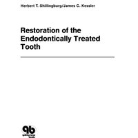 Restoration of the Endodontically Treated Tooth