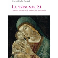 La trisomie 21