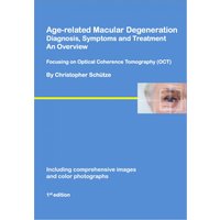 Age-related macular degeneration