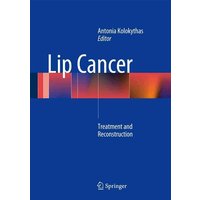 Lip Cancer