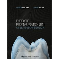 Direkte Restaurationen im Seitenzahnbereich