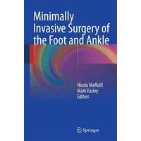 Minimally Invasive Surgery of the Foot and Ankle