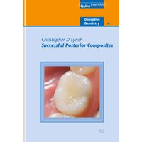 Successful Posterior Composites