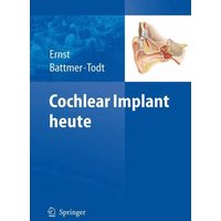 Cochlear Implant heute