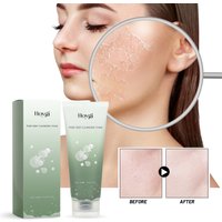 Hoygi Pore Cleansing Cleanser Brightens Facial Skin, Deeply Cleanses Acne Marks, Clears, Moisturizes, and Moisturizes