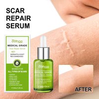 EELHOE repair essence desalinates scars, acne marks, pregnancy, scar repair, smooth skin care