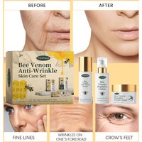 Woodsleep Skin Care Set Moisturizing And Hydrating Essence Cream For Tender Skin Refreshing And Moisturizing Skin Care Set