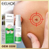 Eelhoe flesh thorns, flat skin, especially hand foot calluses, corns, plantar filamentous warts, and wart remover for