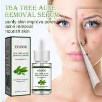 EELHOE Tea Tree Acne Removing&Acne Removing Repair Closed Pore Skin essence