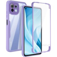 Case Xiaomi Mi 11 Lite Funda Coque Carcasa Luxury 360 Full Protective Phone Case Xiaomi Mi 11Lite Cover Shockpro