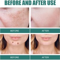 EELHOE Whitening&Attenuating Spot Moisturizing&Attenuating Stain Skin Whitening&Transparent Anti Aging Face