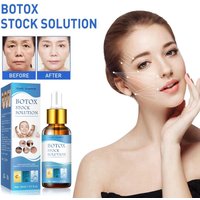 SOL LORA Anti Wrinkle Original Liquid can light fine lines black spots, moisture, tender skin, and prevent aging session
