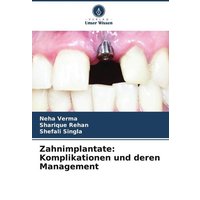 Zahnimplantate: Komplikationen und deren Management