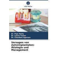 Versagen von Zahnimplantaten: Ätiologie und Management