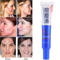 30g Acne Comedo Pimples Removal Shrink Pore Moisturizing Skin Care Cream