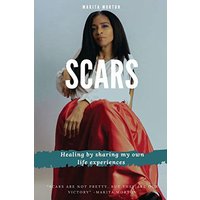 Scars: Healing by sharing my own life experiences - Scars: Healing by sharing my own life experiences - jetzt bei oelder-buchhandlung.de kaufen