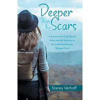 Deeper Than the Scars: A Journey from Cleft Lip and Palate and Self-Rejection to Re-Established Identity Through Christ - Deeper Than the Scars: A Journey from Cleft Lip and Palate and Self-Rejection to Re-Established Identity Through Christ - jetzt bei oelder-buchhandlung.de kaufen