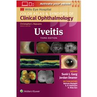 Uveitis: Wills Eye Institute Atlas Series - Uveitis: Wills Eye Institute Atlas Series - jetzt bei oelder-buchhandlung.de kaufen