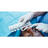Teeth Whitening at Sonria Dental Clinic