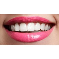 Teeth Cleaning