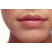 0.5ml or 1ml Dermal Filler for Lips at Studio 9 Advance Treatments