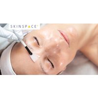 Glow Up with a Multi-Acid Facial Peel for Radiant, Smooth Skin