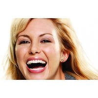 Clear Ceramic or Silver Braces