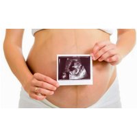 Up to 34% Off on Ultrasound - 3D / 4D at Numi Scan Brentwood