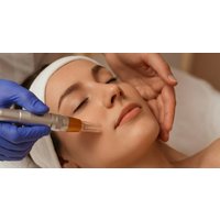 Micro-Needling sessions