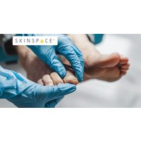 Nail Fungal Laser Treatment at SkinSpaceUK – 6 Locations Nationwide