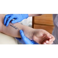 Tattoo Removal on Small, Medium or Large Area at Taras Beauty (Up to 58%