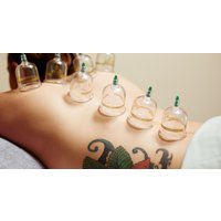 Cupping