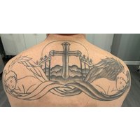 One Session of Tattoo Removal