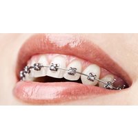 Orthodontist