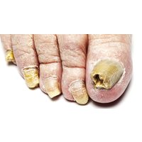 Podiatrist