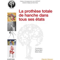 La prothèse totale de hanche dans tous ses états