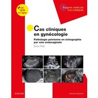 Cas cliniques en imagerie : gynécologie - Pathologie pelvienne en échographie par voie endovaginale