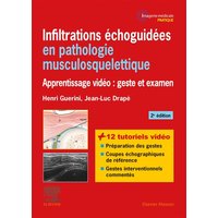 Infiltrations échoguidées en pathologie musculosquelettique : apprentissage vidéo : geste et examen